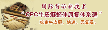 深圳治疗牛皮癣